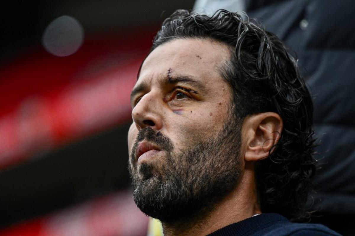 Lyon's Italian head coach Fabio Grosso looks on prior to the French L1 football match between Olympique Lyonnais (OL) and FC Metz at The Groupama Stadium in Decines-Charpieu, central-eastern France on November 5, 2023.  JEFF PACHOUD / AFP