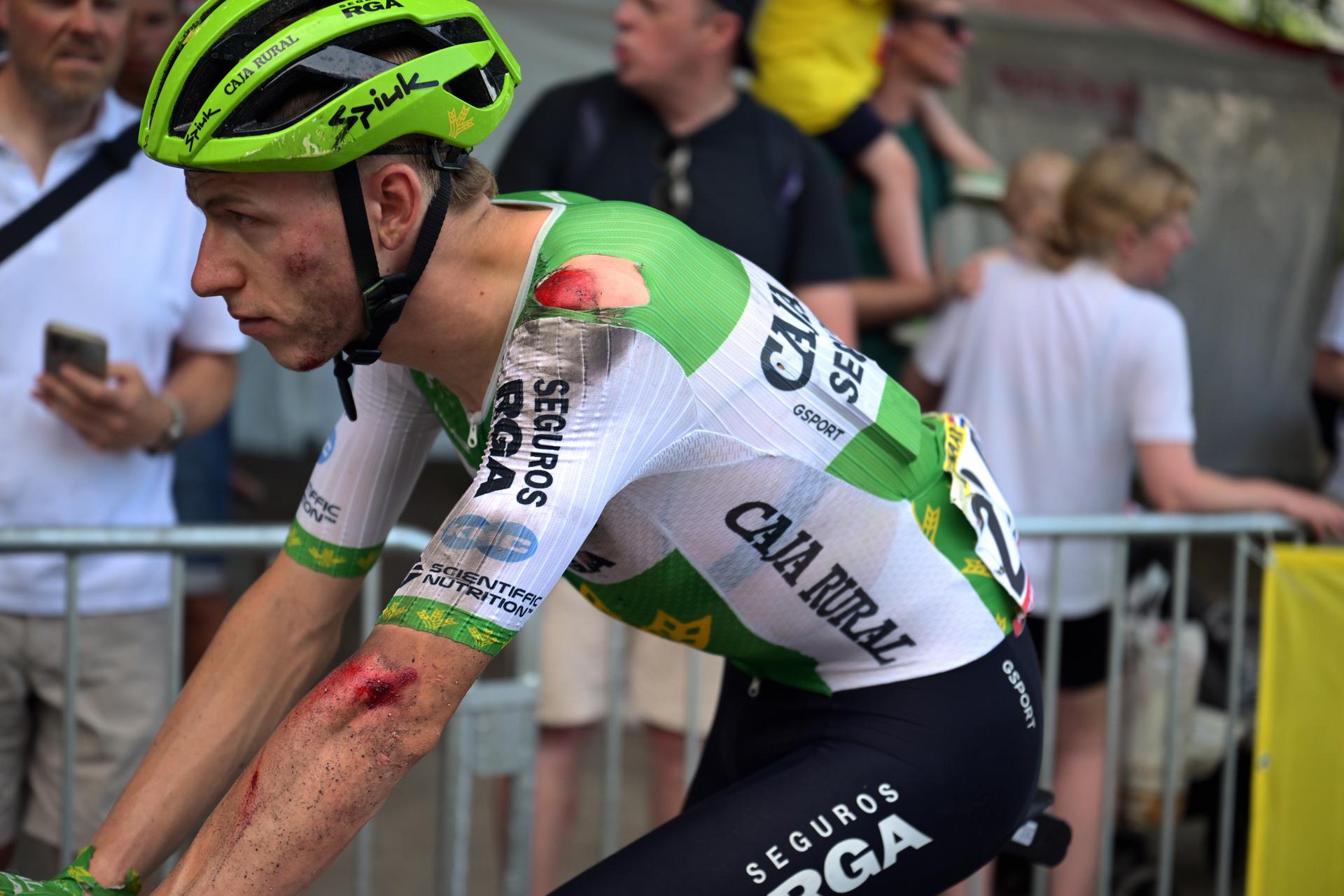 Dutch Alex Molenaar of Caja Rural-Seguros RGA is bruised after a fall at stage 5 of the 2026 Tour de France cycling race, a stage of 158km from Lannemezan to Pau, on Wednesday 08 July 2026. The 113th edition of the Tour de France starts on Saturday 4 July in Barcelona, Spain, and will finish in Paris, France on the 26th of July. BELGA PHOTO DAVID PINTENS